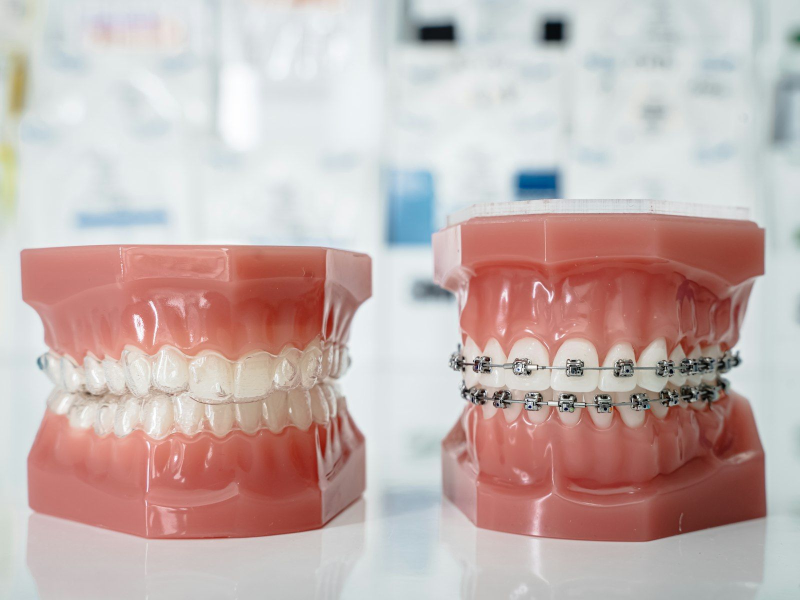 Dos modelos dentales de acrílico, uno con brackets transparentes y otro con brackets metálicos.