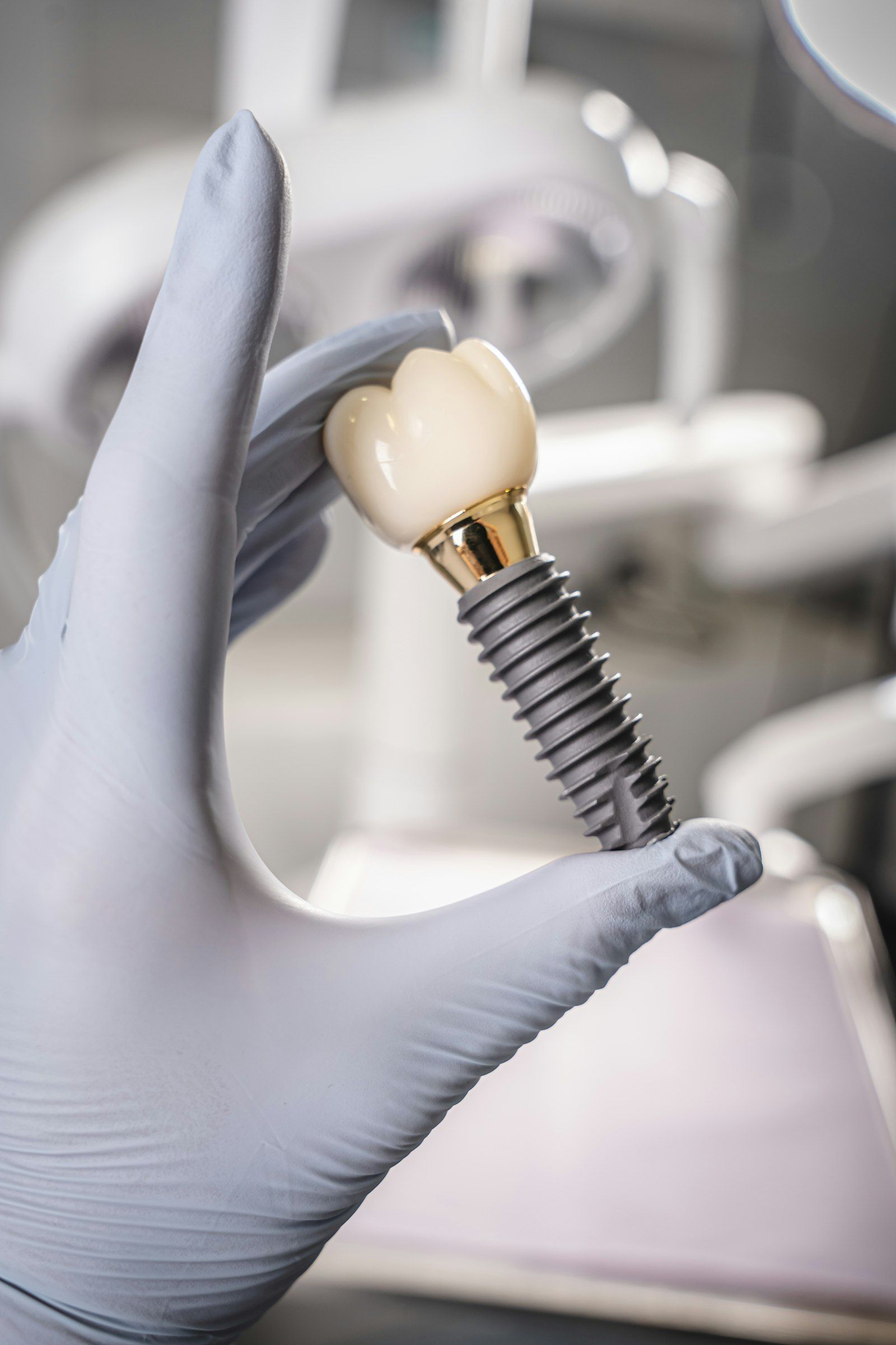 Mano con guante sostiene un modelo de implante dental con su corona.