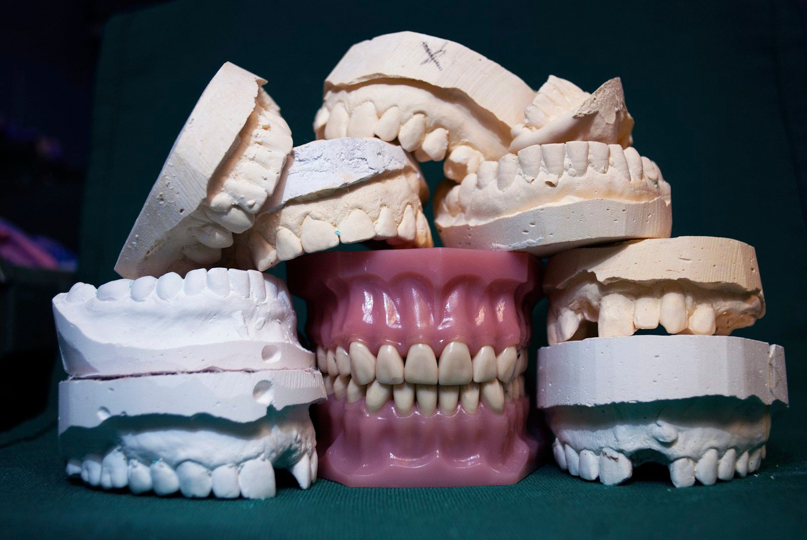 Modelos dentales de yeso apilados sobre una mesa del laboratorio.