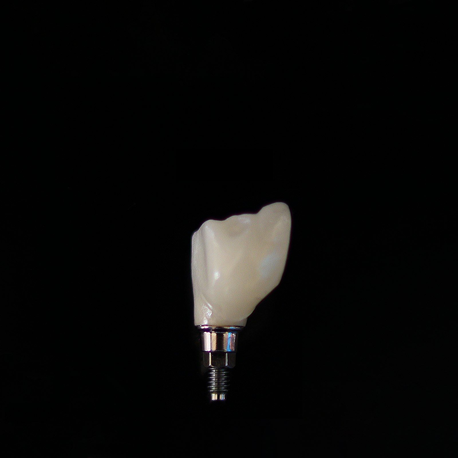 Implante dental con corona de cerámica sobre fondo negro.